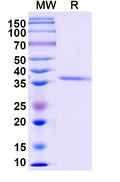 Recombinant Monkeypox virus/MPXV B5R Protein, N-His