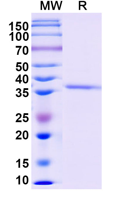 Recombinant Monkeypox virus/MPXV B5R Protein, N-His