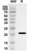 Western blot analysis was performed using anti-Monkeypox virus/MPXV M1R polyclonal antibody at 1ug/mL on recombinant Monkeypox virus/MPXV M1R (Catalog No. VK785012).
