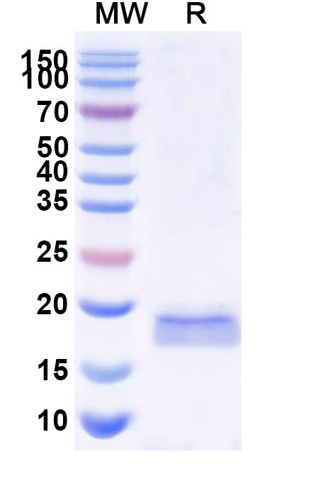 SDS-PAGE for Anti-Monkeypox virus/MPXV M1R Nanobody (SAA2255)