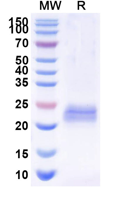 SDS-PAGE for Anti-Bacteriophage 933W stxB2/SLT-2b/VT2 Nanobody (Nb113)