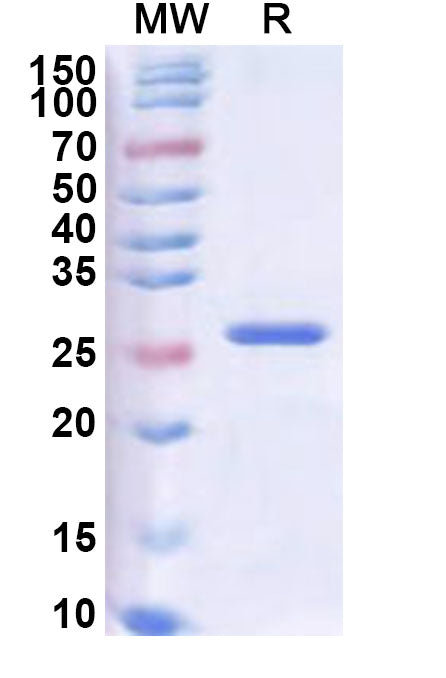 Recombinant ASFV MGF_360-4L Protein, N-His-SUMO