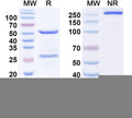 SDS-PAGE for Anti-EBV/HHV4 gB/BALF4 Antibody (1D8).