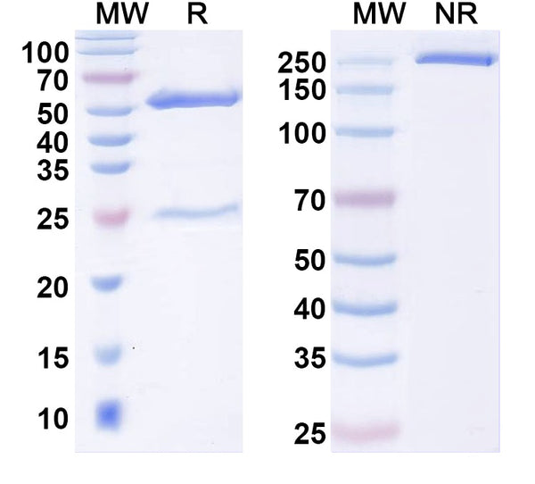 SDS-PAGE for Anti-EBV/HHV4 gB/BALF4 Antibody (AMMO5).