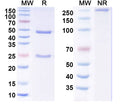 SDS-PAGE for Anti-MERS-CoV RBD Antibody (MCA1)