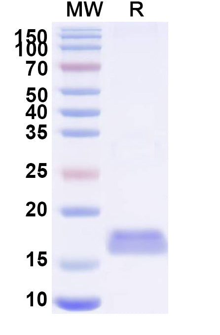SDS-PAGE for Anti-MERS-CoV RBD Nanobody (VHH-55)
