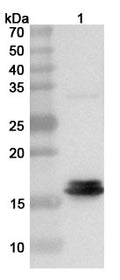 Western blot analysis was performed using anti-FPV-VP1 polyclonal antibody at 1ug/mL on various samples.
Lane 1: recombinant FPV Capsid protein VP1/VP2 (Catalog No: VK804012)