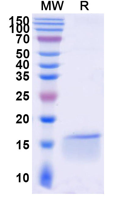 SDS-PAGE for Anti-SARS-CoV-2 NP/Nucleoprotein Nanobody (SAA0961)