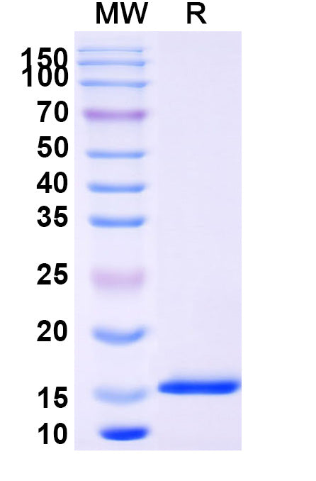 SDS-PAGE for Anti-SARS-CoV-2 NP/Nucleoprotein Nanobody (SAA1347)