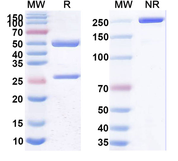 SDS-PAGE for Anti-SARS-CoV-2 NP/Nucleoprotein Antibody (SAA2158)