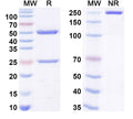 SDS-PAGE for Anti-Human parvovirus B19/HPV-B19 VP2/Viral protein 2 Antibody (SAA0341)