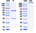 SEC-HPLC detection for Anti-DENV-2 E-DII/Envelope Protein E Antibody (2A10).