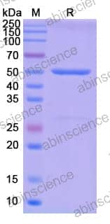 SDS-PAGE for TEV Protease