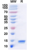 Recombinant LSDV P32/Envelope protein/LSDV074 Protein, N-His