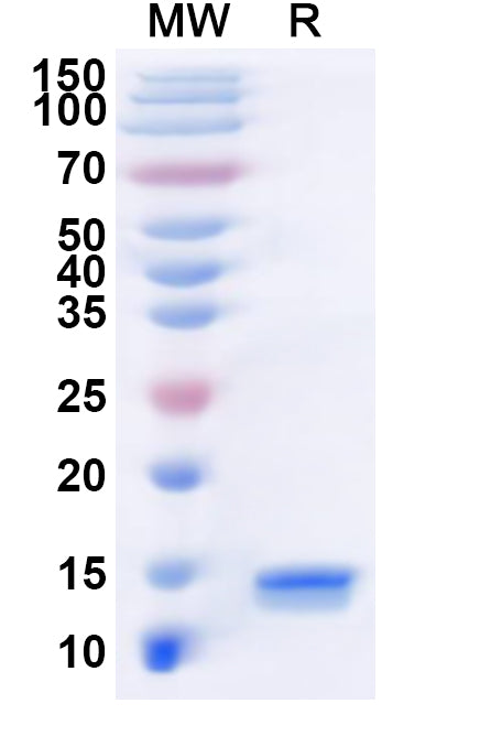 Recombinant LSDV P32/Envelope protein/LSDV074 Protein, N-His