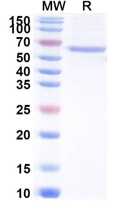 Recombinant ASFV P30/CP204L Protein, N-Fc
