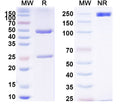 SDS-PAGE for Anti-Human astrovirus-8 Capsid protein VP25 Antibody (2D9)