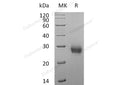 Recombinant Human RANK/TNFRSF11A Protein (His Tag) – Figure 1 of 2