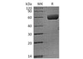 Recombinant Human FAM3B (C-Fc) – Figure 1 of 2