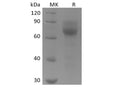 Recombinant Human Tyrosine-protein kinase receptor UFO/AXL oncogene/UFO (C-6His) – Figure 1 of 2