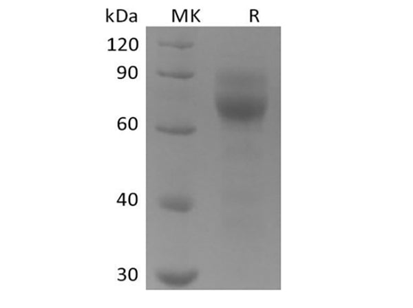Recombinant Human Tyrosine-protein kinase receptor UFO/AXL oncogene/UFO (C-6His) – Figure 1 of 2