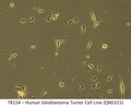 Human Glioblastoma Tumor Cell Line (QNS315) | Applied Biological Materials (abm)