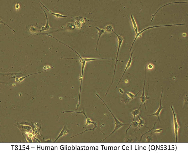 Human Glioblastoma Tumor Cell Line (QNS315) | Applied Biological Materials (abm)