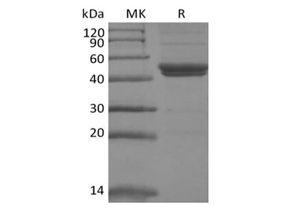 Recombinant Mouse IL-11RA (C-6His) – Figure 1 of 2