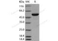 Recombinant Human MERTK/MER Protein (His&GST Tag) – Figure 1 of 2