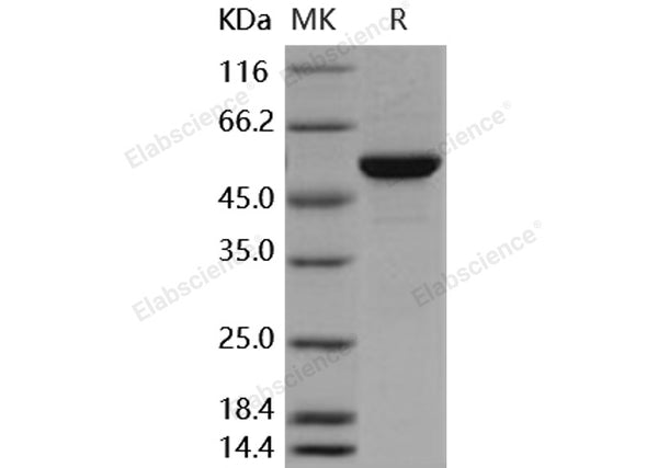 Recombinant Human MERTK/MER Protein (His&GST Tag) – Figure 1 of 2