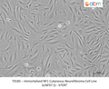 Immortalized NF1 Cutaneous Neurofibroma Cell Line (icNF97.5) - hTERT – Figure 1 of 1