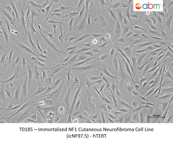 Immortalized NF1 Cutaneous Neurofibroma Cell Line (icNF97.5) - hTERT – Figure 1 of 1