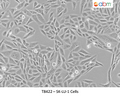 SK-LU-1 Cells | Applied Biological Materials (abm)