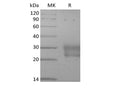 Recombinant Human Frizzled-8 (C-6His) – Figure 1 of 2