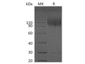 Recombinant HIV Recombinant HIV gp120 Protein (His Tag) – Figure 1 of 2