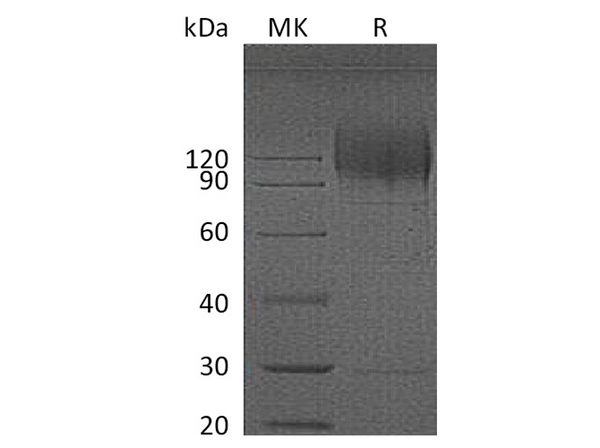 Recombinant HIV Recombinant HIV gp120 Protein (His Tag) – Figure 1 of 2