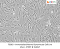 Immortalized Normal Synoviocyte Cell Line (iSin) - hTERT & SV40LT – Figure 1 of 1