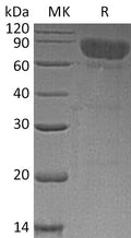 Recombinant Human TCblR/8D6A Protein (Fc Tag) – Figure 1 of 2