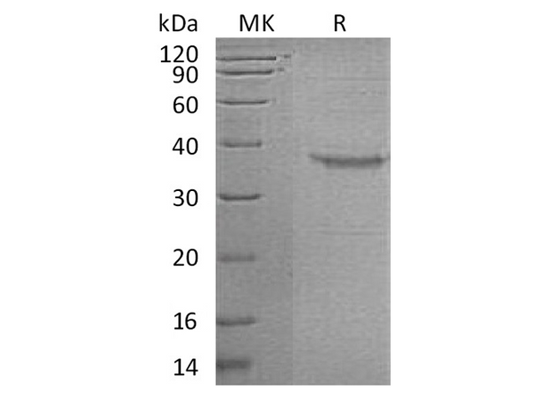 Recombinant Human Somatoliberin/GHRH Protein (Fc Tag) – Figure 1 of 2