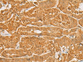 MAPK14 Polyclonal Antibody – Figure 1 of 2