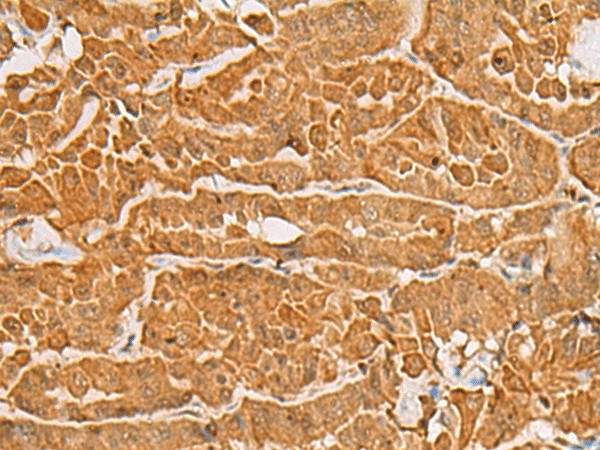 MAPK14 Polyclonal Antibody – Figure 1 of 2