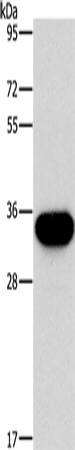 HOXB13 Polyclonal Antibody – Figure 1 of 2