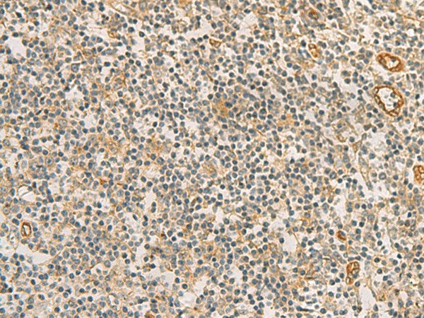 RAB13 Polyclonal Antibody – Figure 1 of 3