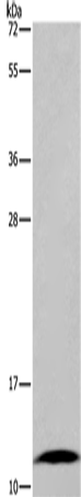 FABP6 Polyclonal Antibody – Figure 1 of 3