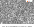 Lymph Node Metastasis Melanoma Cell Line (MM034) | Applied Biological Materials (abm)