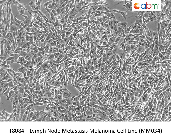 Lymph Node Metastasis Melanoma Cell Line (MM034) | Applied Biological Materials (abm)