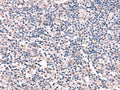 ESM1 Polyclonal Antibody – Figure 1 of 3