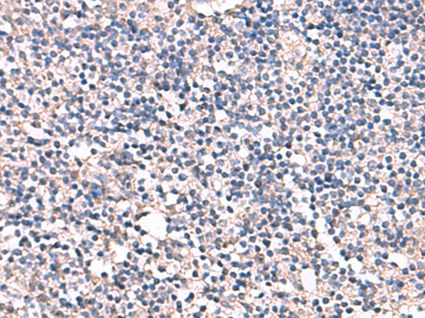 ESM1 Polyclonal Antibody – Figure 1 of 3