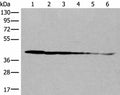 PITPNB Polyclonal Antibody – Figure 1 of 3