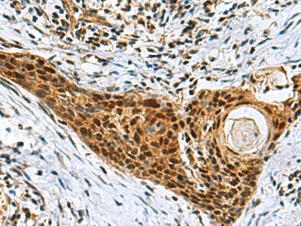 NABP1 Polyclonal Antibody – Figure 1 of 2